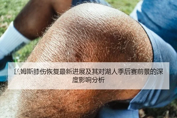 詹姆斯膝伤恢复最新进展及其对湖人季后赛前景的深度影响分析